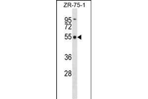 FBXO5 Antibody (Center) (ABIN1538021 and ABIN2848460) western blot analysis in ZR-75-1 cell line lysates (35 μg/lane). (FBXO5 anticorps  (AA 192-221))