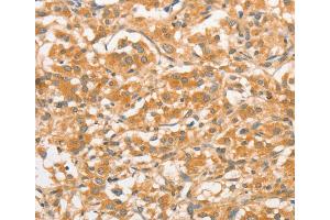 Immunohistochemistry (IHC) image for anti-Toll-Like Receptor 3 (TLR3) antibody (ABIN2422741) (TLR3 anticorps)
