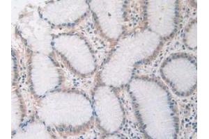 Figure. (SIRT4 anticorps  (AA 28-314))