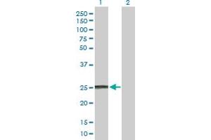 Western Blot analysis of IFNA8 expression in transfected 293T cell line by IFNA8 MaxPab polyclonal antibody. (IFNA8 anticorps  (AA 1-189))