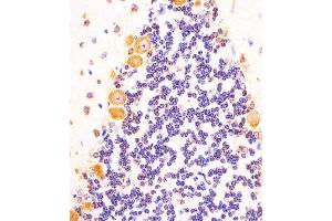 (ABIN6242830 and ABIN6577992) staining (Mouse) Shh in mouse cerebellum sections by Immunohistochemistry (IHC-P - paraformaldehyde-fixed, paraffin-embedded sections).