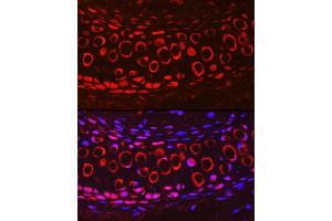 Immunofluorescence analysis of Mouse cartilage using COMP Rabbit pAb (ABIN6127650, ABIN6138864, ABIN6138866 and ABIN6221502) at dilution of 1:200 (40x lens). (COMP anticorps  (AA 20-160))
