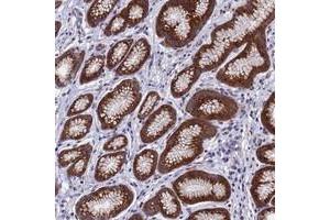 Immunohistochemical staining of human stomach with NSUN6 polyclonal antibody  shows strong granular cytoplasmic positivity in glandular cells at 1:10-1:20 dilution. (NSUN6 anticorps)