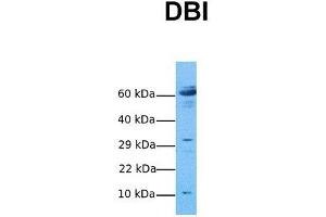 Host:  Rabbit  Target Name:  DBI  Sample Tissue:  Human Ovary Tumor  Antibody Dilution:  1. (Diazepam Binding Inhibitor anticorps  (N-Term))