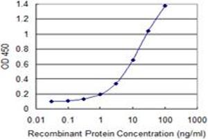 Detection limit for recombinant GST tagged MCM3AP is 0.