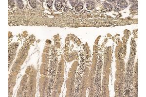 Cingulin Mouse Monoclonal Antibody at 1/100 staining rat colorectal tissue by IHC-P. (Cingulin anticorps)