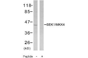 Image no. 2 for anti-Mitogen-Activated Protein Kinase Kinase 4 (MAP2K4) (Ser80) antibody (ABIN197325) (MAP2K4 anticorps  (Ser80))
