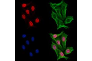 ABIN6254860 and ABIN6267065 staining H2O2 treated Hela cells by IF/ICC.