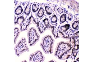 IHC analysis of HnRNPF using anti-HnRNPF antibody (ABIN4886622). (HNRNPF anticorps  (N-Term))