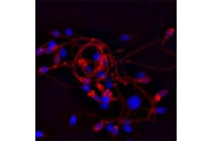 IF on ethanol-fixed human spermatosoid using Mouse monoclonal to Cathelicidin: OSX12 clone  at a concentration of 10 µg/ml.