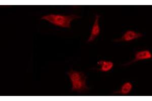 ABIN6274527 staining Hela by IF/ICC. (DNAJC17 anticorps  (N-Term))