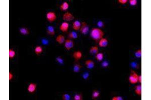 Immunofluorescence (IF) image for anti-Colony Stimulating Factor 1 Receptor (CSF1R) antibody (Alexa Fluor 594) (ABIN2656811)