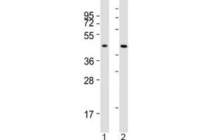 Western blot testing of ACAT1 antibody at 1:2000 dilution.