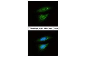 ICC/IF Image Immunofluorescence analysis of methanol-fixed HeLa, using LDH-B, antibody at 1:50 dilution. (LDHB anticorps)