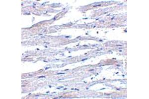 Immunohistochemistry of DDX58 in human heart tissue with DDX58 polyclonal antibody  at 5 ug/mL . (DDX58 anticorps)