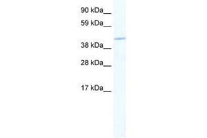 WB Suggested Anti-MEF2C Antibody Titration:  2. (MEF2C anticorps  (N-Term))