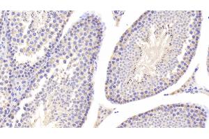 Detection of LDHB in Mouse Testis Tissue using Polyclonal Antibody to Lactate Dehydrogenase B (LDHB)