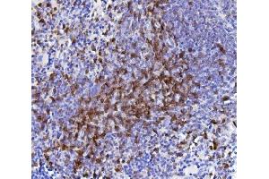 IHC analysis of CD5 using anti-CD5 antibody (ABIN7600841).