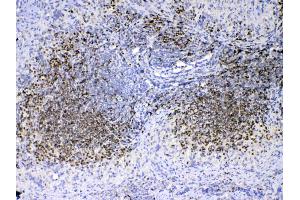 IHC analysis of PAX5 using anti-PAX5 antibody .