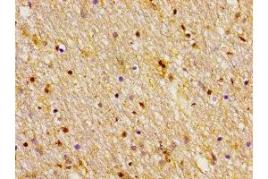 Immunohistochemistry of paraffin-embedded human brain tissue using ABIN7153179 at dilution of 1:100 (FZD10 anticorps  (AA 125-225))