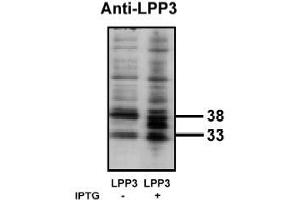 Image no. 1 for anti-Phosphatidic Acid Phosphatase Type 2B (PPAP2B) antibody (ABIN265045) (PPAP2B anticorps)
