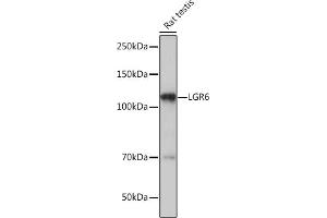Western blot analysis of extracts of Rat testis, using LGR6 Rabbit mAb (ABIN7268235) at 1:1000 dilution.