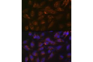 Immunofluorescence analysis of U-251 MG cells using IGFBP7 Rabbit mAb (ABIN7267910) at dilution of 1:100 (40x lens). (IGFBP7 anticorps)