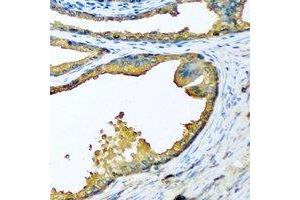 Immunohistochemical analysis of HPA2 staining in human prostate formalin fixed paraffin embedded tissue section.