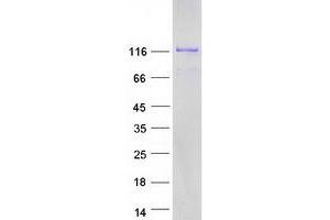 Validation with Western Blot