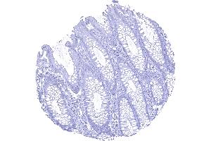 Colon descendes mucosa Calbindin 1 immunostaining is absent in all cells of the colon mucosa