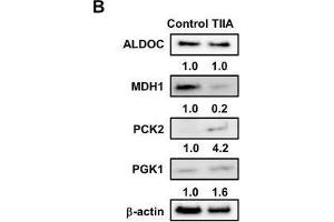Treatment with TIIA changes the expression of glucose metabolism-related proteins in AGS cells.