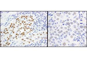 Immunohistochemistry (IHC) image for anti-Minichromosome Maintenance Complex Component 5 (MCM5) (AA 1-50) antibody (ABIN7454594)