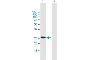 Western Blot analysis of AGPAT1 expression in transfected 293T cell line by AGPAT1 MaxPab polyclonal antibody. (AGPAT1 anticorps  (AA 1-283))