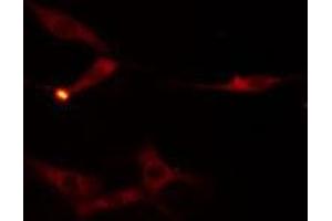 ABIN6275948 staining  HuvEc cells by IF/ICC.