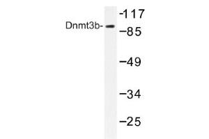 Image no. 1 for anti-DNA (Cytosine-5-)-Methyltransferase 3 beta (DNMT3B) antibody (ABIN317617) (DNMT3B anticorps)