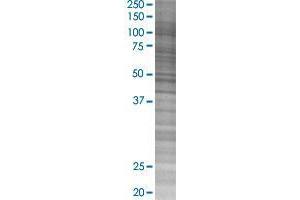PPP1R16B transfected lysate. (PPP1R16B 293T Cell Transient Overexpression Lysate(Denatured))