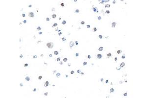 Immunocytochemistry (ICC) image for anti-V-Myb Myeloblastosis Viral Oncogene Homolog (Avian) (MYB) (AA 1-50) antibody (ABIN7795807)