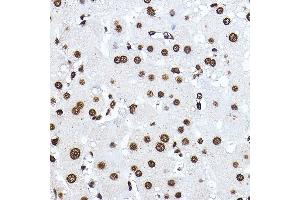 Immunohistochemistry of paraffin-embedded human liver using Histone H3 Rabbit pAb (ABIN3023242, ABIN3023243, ABIN3023244, ABIN1513010 and ABIN6219504) at dilution of 1:100 (40x lens). (Histone 3 anticorps  (C-Term))