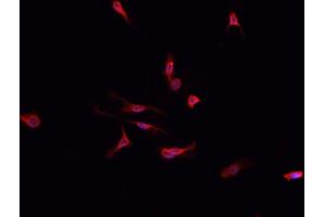 ABIN6276770 staining HepG2? (DPYD anticorps  (Internal Region))