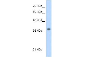 WB Suggested Anti-LDB1 Antibody Titration:  0. (LIM Domain Binding 1 Protein anticorps  (C-Term))