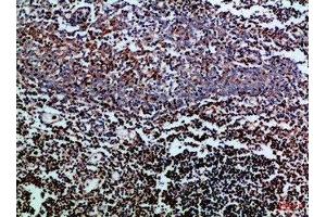 Immunohistochemical analysis of paraffin-embedded Human-tonsil, antibody was diluted at 1:100