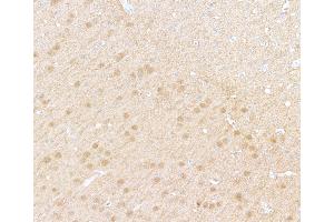 Immunohistochemistry (IHC) image for anti-Ubiquitin Carboxyl-terminal Esterase L1 (Ubiquitin Thiolesterase) (UCHL1) (AA 50-100) antibody (ABIN7449527)