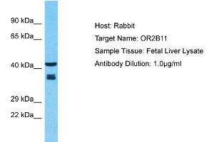 Host: Rabbit Target Name: OR2B11 Sample Type: Fetal Liver lysates Antibody Dilution: 1. (OR2B11 anticorps  (C-Term))