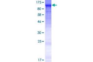 Image no. 1 for Molybdenum Cofactor Sulfurase (MOCOS) (AA 1-888) protein (GST tag) (ABIN1311134)