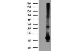 Western Blotting (WB) image for anti-Spermidine/Spermine N1-Acetyltransferase 2 (SAT2) antibody (ABIN1500807) (SAT2 anticorps)