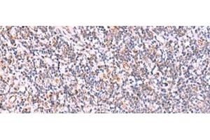 Immunohistochemistry of paraffin-embedded Human tonsil tissue using ITPKC Polyclonal Antibody at dilution of 1:40(x200) (ITPKC anticorps)