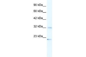 WB Suggested Anti-ZNF265 Antibody Titration:  1. (ZNF265 anticorps  (N-Term))