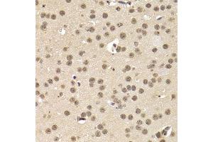 Immunohistochemistry of paraffin-embedded mouse brain using CREB1 Antibody. (CREB1 anticorps)