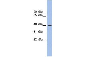 WB Suggested Anti-GLI4 Antibody Titration: 0.