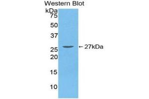 Western blot analysis of the recombinant protein. (TGFBI anticorps  (AA 423-632))